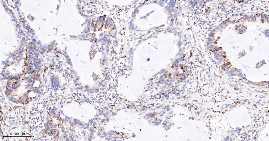 人丙酮酸脱氢酶激酶亚型2即用型免疫组化试剂盒-IHC0692H